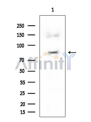 JIP2 Mouse Monoclonal Antibody - Western blot analysis of extracts from EC304 cells, using JIP2 Mouse Monoclonal Antibody at 1/1000 dilution.