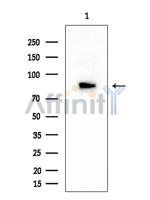 JIP2 Mouse Monoclonal Antibody - Western blot analysis of extracts from Mouse liver, using JIP2 Mouse Monoclonal Antibody at 1/1000 dilution.