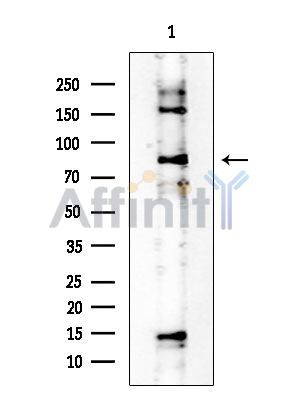 NFE2L1 Mouse Monoclonal Antibody - Western blot analysis of extracts from EC304 cells, using NFE2L1 Mouse Monoclonal Antibody at 1/1000 dilution.