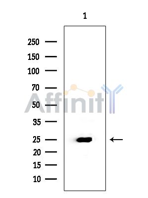 UBE2D1 Mouse Monoclonal Antibody - Western blot analysis of extracts from Mouse liver, using UBE2D1 Mouse Monoclonal Antibody at 1/1000 dilution.