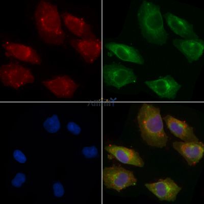 Collagen III Antibody - AF5457 staining A375 cells by IF/ICC.