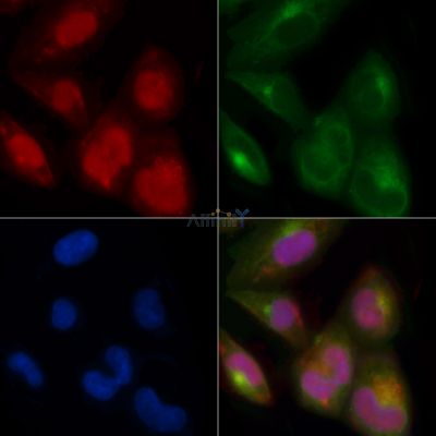 PRAME Antibody - DF12547 staining A375 cells by IF/ICC.