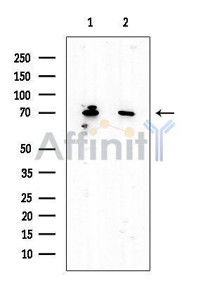 AKT1 Mouse Monoclonal Antibody - Western blot analysis of extracts from various samples, using AKT1 Mouse Monoclonal Antibody at 1/1000 dilution.