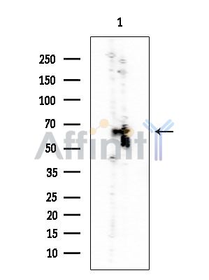 RUNX2 Mouse Monoclonal Antibody - Western blot analysis of extracts from Mouse liver, using RUNX2 Mouse Monoclonal Antibody at 1/1000 dilution.