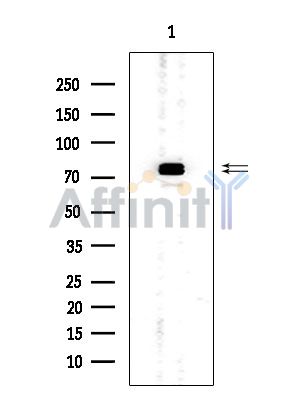Synapsin I Mouse Monoclonal Antibody - Western blot analysis of extracts from Mouse brain, using Synapsin I Mouse Monoclonal Antibody at 1/1000 dilution.