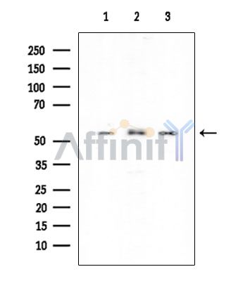 PHGDH Mouse Monoclonal Antibody - Western blot analysis of extracts from various samples, using PHGDH Mouse Monoclonal Antibody at 1/1000 dilution.
