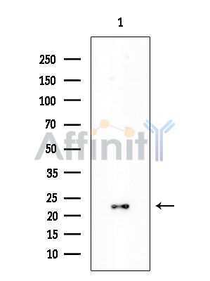 SOD2/MnSOD Mouse Monoclonal Antibody - Western blot analysis of extracts from Mouse liver, using SOD2/MnSOD Mouse Monoclonal Antibody at 1/1000 dilution.