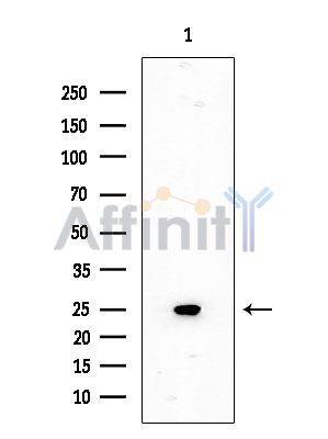 SOD2/MnSOD Mouse Monoclonal Antibody - Western blot analysis of extracts from EC304 cells, using SOD2/MnSOD Mouse Monoclonal Antibody at 1/1000 dilution.