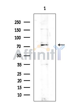 Scavenger Receptor BII Mouse Monoclonal Antibody - Western blot analysis of extracts from EC304 cells, using Scavenger Receptor BII Mouse Monoclonal Antibody at 1/1000 dilution.