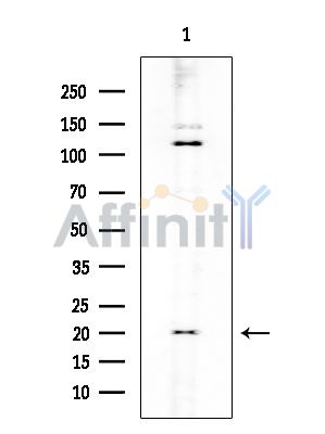 CDKN3 Mouse Monoclonal Antibody - Western blot analysis of extracts from Rat testis, using CDKN3 Mouse Monoclonal Antibody at 1/1000 dilution.