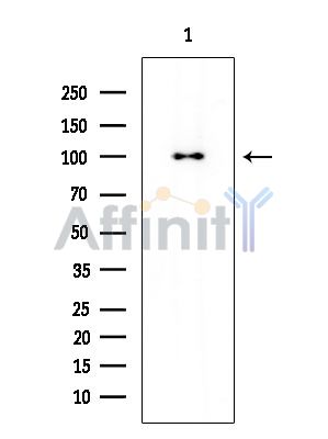 TLR2 Mouse Monoclonal Antibody - Western blot analysis of extracts from Mouse liver, using TLR2 Mouse Monoclonal Antibody at 1/1000 dilution.