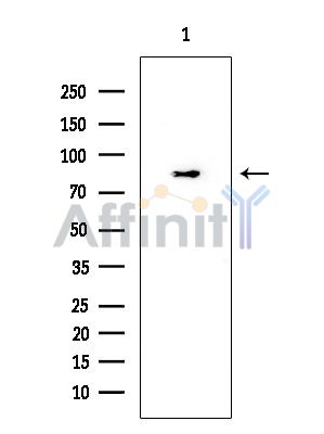 TLR2 Mouse Monoclonal Antibody - Western blot analysis of extracts from EC304 cells, using TLR2 Mouse Monoclonal Antibody at 1/1000 dilution.