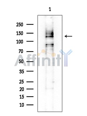 MAGEC1 Mouse Monoclonal Antibody - Western blot analysis of extracts from Mouse liver, using MAGEC1 Mouse Monoclonal Antibody at 1/1000 dilution.
