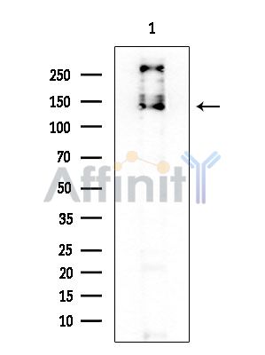 DZIP3 Mouse Monoclonal Antibody - Western blot analysis of extracts from EC304 cells, using DZIP3 Mouse Monoclonal Antibody at 1/1000 dilution.