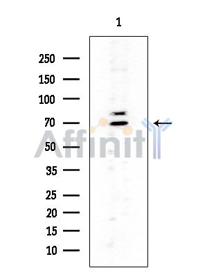 RHPN1 Mouse Monoclonal Antibody - Western blot analysis of extracts from Rat testis, using RHPN1 Mouse Monoclonal Antibody at 1/1000 dilution.