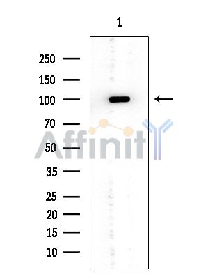 RHPN1 Mouse Monoclonal Antibody - Western blot analysis of extracts from HUVEC cells, using RHPN1 Mouse Monoclonal Antibody at 1/1000 dilution.