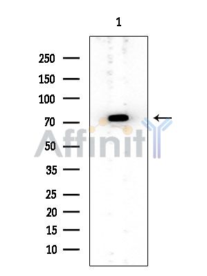 RHPN1 Mouse Monoclonal Antibody - Western blot analysis of extracts from EC304 cells, using RHPN1 Mouse Monoclonal Antibody at 1/1000 dilution.