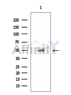 KATNAL1 Mouse Monoclonal Antibody - Western blot analysis of extracts from HUVEC cells, using KATNAL1 Mouse Monoclonal Antibody at 1/1000 dilution.