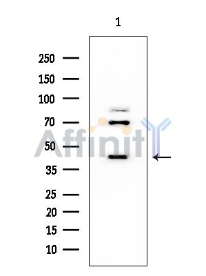 HFE2 Mouse Monoclonal Antibody - Western blot analysis of extracts from EC304 cells, using HFE2 Mouse Monoclonal Antibody at 1/1000 dilution.
