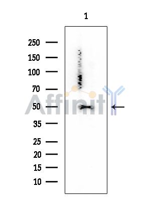 PDCD4 Mouse Monoclonal Antibody - Western blot analysis of extracts from EC304 cells, using PDCD4 Mouse Monoclonal Antibody at 1/1000 dilution.