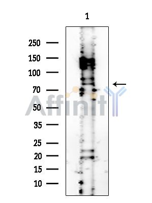 PFKP Mouse Monoclonal Antibody - Western blot analysis of extracts from PC12 cells, using PFKP Mouse Monoclonal Antibody at 1/1000 dilution.
