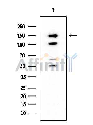 Collagen IV  alpha 2 Mouse Monoclonal Antibody - Western blot analysis of extracts from HUVEC cells, using Collagen IV  alpha 2 Mouse Monoclonal Antibody at 1/1000 dilution.