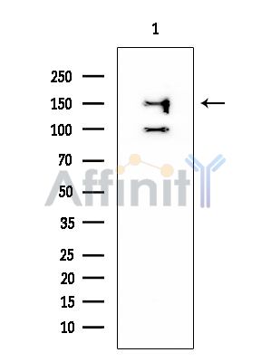 Collagen IV  alpha 2 Mouse Monoclonal Antibody - Western blot analysis of extracts from EC304 cells, using Collagen IV  alpha 2 Mouse Monoclonal Antibody at 1/1000 dilution.