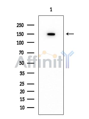 Collagen IV  alpha 2 Mouse Monoclonal Antibody - Western blot analysis of extracts from Rat testis, using Collagen IV  alpha 2 Mouse Monoclonal Antibody at 1/1000 dilution.