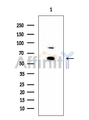 Cytochrome P450 2A13 Mouse Monoclonal Antibody - Western blot analysis of extracts from PC12 cells, using Cytochrome P450 2A13 Mouse Monoclonal Antibody at 1/1000 dilution.