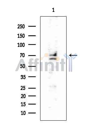 NUMB Mouse Monoclonal Antibody - Western blot analysis of extracts from PC12 cells, using NUMB Mouse Monoclonal Antibody at 1/1000 dilution.