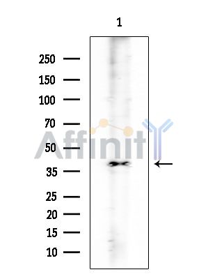 ANGPTL4 Mouse Monoclonal Antibody - Western blot analysis of extracts from Rat testis, using ANGPTL4 Mouse Monoclonal Antibody at 1/1000 dilution.