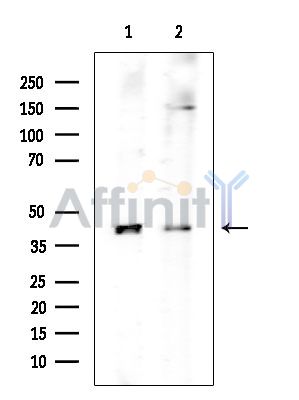 ANGPTL4 Mouse Monoclonal Antibody - Western blot analysis of extracts from various samples, using ANGPTL4 Mouse Monoclonal Antibody at 1/1000 dilution.