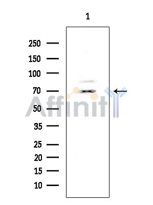 SELE/CD62E Mouse Monoclonal Antibody - Western blot analysis of extracts from HUVEC cells, using SELE/CD62E Mouse Monoclonal Antibody at 1/1000 dilution.