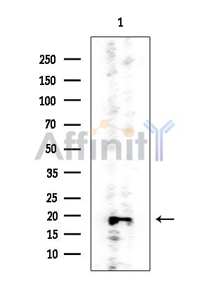 PSMB5 Mouse Monoclonal Antibody - Western blot analysis of extracts from HUVEC cells, using PSMB5 Mouse Monoclonal Antibody at 1/1000 dilution.
