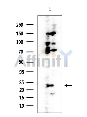 PSMB5 Mouse Monoclonal Antibody - Western blot analysis of extracts from Mouse liver, using PSMB5 Mouse Monoclonal Antibody at 1/1000 dilution.