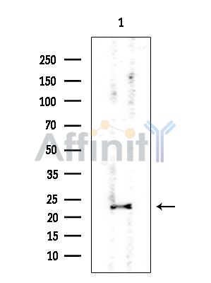 PSMB5 Mouse Monoclonal Antibody - Western blot analysis of extracts from EC304 cells, using PSMB5 Mouse Monoclonal Antibody at 1/1000 dilution.