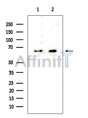 GPC3 Mouse Monoclonal Antibody - Western blot analysis of extracts from various samples, using GPC3 Mouse Monoclonal Antibody at 1/1000 dilution.