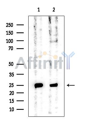GSTP1 Mouse Monoclonal Antibody - Western blot analysis of extracts from various samples, using GSTP1 Mouse Monoclonal Antibody at 1/1000 dilution.
