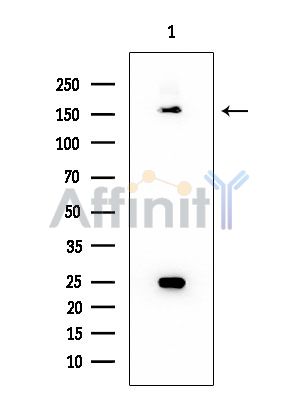 TAO2 Mouse Monoclonal Antibody - Western blot analysis of extracts from COLO205 cells, using TAO2 Mouse Monoclonal Antibody at 1/1000 dilution.