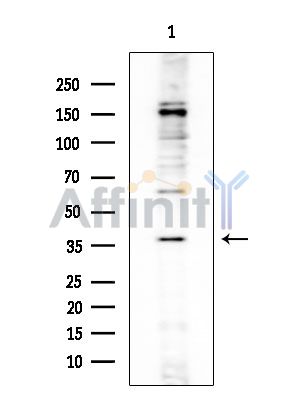 OR5R1 Mouse Monoclonal Antibody - Western blot analysis of extracts from EC304 cells, using OR5R1 Mouse Monoclonal Antibody at 1/1000 dilution.