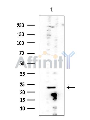 DIABLO Mouse Monoclonal Antibody - Western blot analysis of extracts from EC304 cells, using DIABLO Mouse Monoclonal Antibody at 1/1000 dilution.