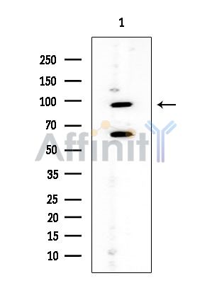 TAS1R2 Mouse Monoclonal Antibody - Western blot analysis of extracts from HUVEC cells, using TAS1R2 Mouse Monoclonal Antibody at 1/1000 dilution.