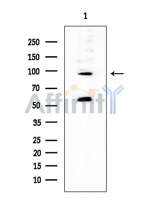 TAS1R2 Mouse Monoclonal Antibody - Western blot analysis of extracts from EC304 cells, using TAS1R2 Mouse Monoclonal Antibody at 1/1000 dilution.