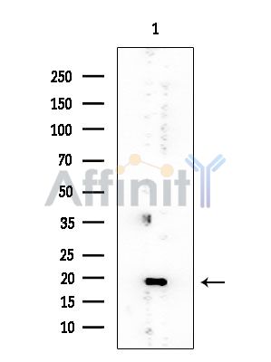 PPP1R14B Mouse Monoclonal Antibody - Western blot analysis of extracts from EC304 cells, using PPP1R14B Mouse Monoclonal Antibody at 1/1000 dilution.