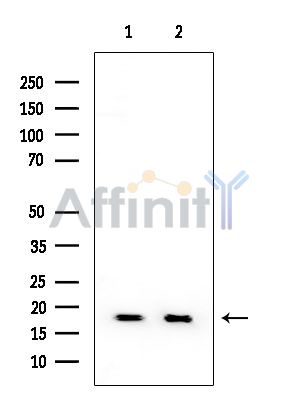 RPL29 Mouse Monoclonal Antibody - Western blot analysis of extracts from various samples, using RPL29 Mouse Monoclonal Antibody at 1/1000 dilution.