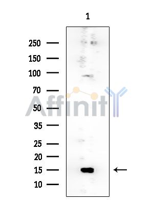 RPL24 Mouse Monoclonal Antibody - Western blot analysis of extracts from Mouse liver, using RPL24 Mouse Monoclonal Antibody at 1/1000 dilution.