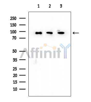 ADAM23 Mouse Monoclonal Antibody - Western blot analysis of extracts from various samples, using ADAM23 Mouse Monoclonal Antibody at 1/1000 dilution.