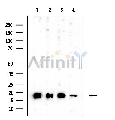 KLRC2/4 Mouse Monoclonal Antibody - Western blot analysis of extracts from various samples, using KLRC2/4 Mouse Monoclonal Antibody at 1/1000 dilution.