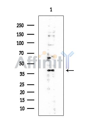 EBP2 Mouse Monoclonal Antibody - Western blot analysis of extracts from EC304 cells, using EBP2 Mouse Monoclonal Antibody at 1/1000 dilution.