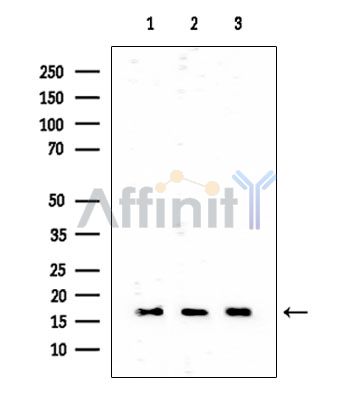 HES3 Mouse Monoclonal Antibody - Western blot analysis of extracts from various samples, using HES3 Mouse Monoclonal Antibody at 1/1000 dilution.